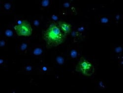 LPAR1/LPA1/EDG-2 Antibody (OTI1G6), Novus Biologicals 0.1mL; Unlabeled:Antibodies,