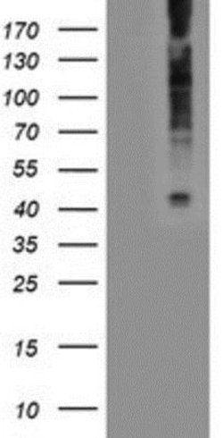 LPAR1/LPA1/EDG-2 Antibody (OTI1G6), Novus Biologicals 0.1mL; Unlabeled:Antibodies,