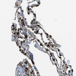 LPCAT1 Antibody, Novus Biologicals:Antibodies:Primary Antibodies