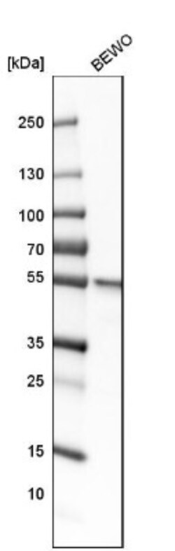 LPCAT1 Antibody, Novus Biologicals 25 &mu;L; Unlabeled:Antibodies, Polyclonal