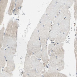 LPCAT2 Antibody, Novus Biologicals 25 &mu;L; Unlabeled:Antibodies, Polyclonal