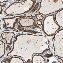 LPCAT2 Antibody, Novus Biologicals 25 &mu;L; Unlabeled:Antibodies, Polyclonal