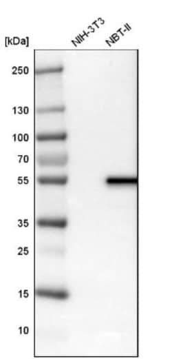 LPCAT2 Antibody, Novus Biologicals 25 &mu;L; Unlabeled:Antibodies, Polyclonal