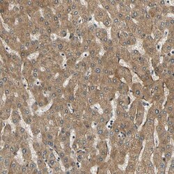 LPGAT1 Antibody, Novus Biologicals 25 &mu;L; Unlabeled:Antibodies, Polyclonal