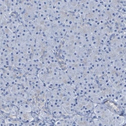 LPP Antibody, Novus Biologicals:Antibodies:Primary Antibodies