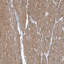 LPP Antibody, Novus Biologicals:Antibodies:Primary Antibodies