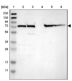 LPP Antibody, Novus Biologicals 0.1mL; Unlabeled:Antibodies, Polyclonal