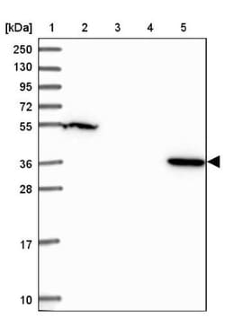 LPPR2 Antibody, Novus Biologicals 0.1mL; Unlabeled:Antibodies, Polyclonal