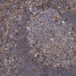 LRBA Antibody, Novus Biologicals:Antibodies:Primary Antibodies
