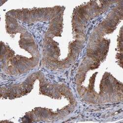 LRBA Antibody, Novus Biologicals:Antibodies:Primary Antibodies