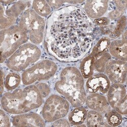 LRBA Antibody, Novus Biologicals:Antibodies:Primary Antibodies