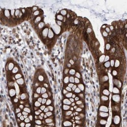 LRBA Antibody, Novus Biologicals:Antibodies:Primary Antibodies