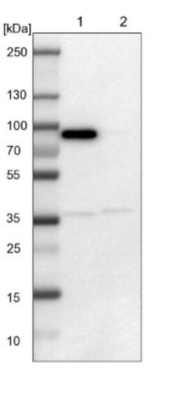 LRCH3 Antibody, Novus Biologicals 25 &mu;L; Unlabeled:Antibodies, Polyclonal