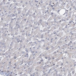 LRCH4 Antibody, Novus Biologicals 0.1mL; Unlabeled:Antibodies, Polyclonal