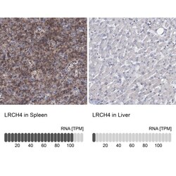 LRCH4 Antibody, Novus Biologicals 0.1mL; Unlabeled:Antibodies, Polyclonal