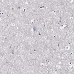 LRG1 Antibody, Novus Biologicals 25 &mu;L | Buy Online | Novus Biologicals | Fisher Scientific