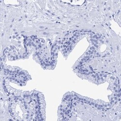 INSL6 Antibody, Novus Biologicals:Antibodies:Primary Antibodies