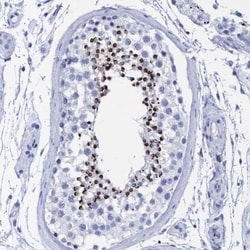 INSL6 Antibody, Novus Biologicals:Antibodies:Primary Antibodies