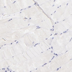LRMP/Jaw1 Antibody, Novus Biologicals:Antibodies:Primary Antibodies