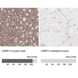 LRMP/Jaw1 Antibody, Novus Biologicals:Antibodies:Primary Antibodies
