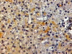 LRP-5 Antibody, Novus Biologicals 0.1mg; Unlabeled:Antibodies, Polyclonal