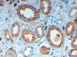 LRP-6 Antibody, Novus Biologicals 0.1mg; Unlabeled:Antibodies, Polyclonal