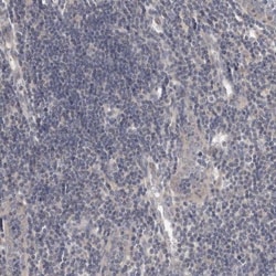 LRP-6 Antibody, Novus Biologicals 0.1mL; Unlabeled:Antibodies, Polyclonal