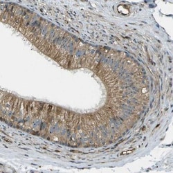 ST7/LRP12 Antibody, Novus Biologicals 0.1mL; Unlabeled:Antibodies, Polyclonal