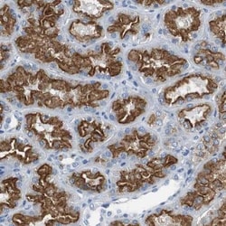 LRP2 Antibody, Novus Biologicals 0.1mL; Unlabeled:Anticorps, Polyclonal