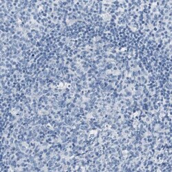 LRP2 Antibody, Novus Biologicals 0.1mL; Unlabeled:Anticorps, Polyclonal