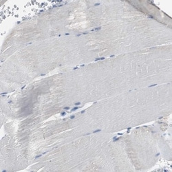 LRP2 Antibody, Novus Biologicals 0.1mL; Unlabeled:Anticorps, Polyclonal