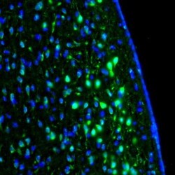 LRPAP Antibody, Novus Biologicals 0.1mL; Unlabeled:Antibodies, Polyclonal