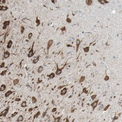 LRPAP Antibody, Novus Biologicals 0.1mL; Unlabeled:Antibodies, Polyclonal