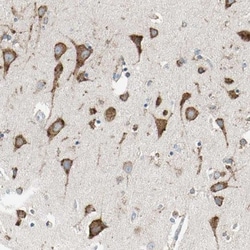 LRPAP Antibody, Novus Biologicals 0.1mL; Unlabeled:Antibodies, Polyclonal