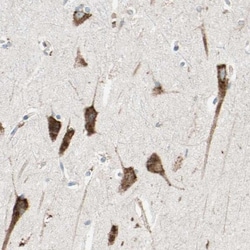 LRPAP Antibody, Novus Biologicals 0.1mL; Unlabeled:Antibodies, Polyclonal