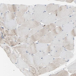 LRPAP Antibody, Novus Biologicals 0.1mL; Unlabeled:Antibodies, Polyclonal