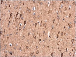 LRPAP Antibody, Novus Biologicals 0.1mL; Unlabeled:Antibodies, Polyclonal