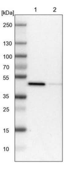 LRPAP Antibody, Novus Biologicals 0.1mL; Unlabeled:Antibodies, Polyclonal