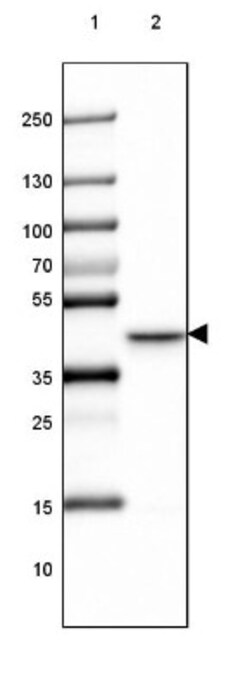 LRPAP Antibody, Novus Biologicals 0.1mL; Unlabeled:Antibodies, Polyclonal