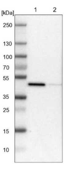 LRPAP Antibody, Novus Biologicals 0.1mL; Unlabeled:Antibodies, Polyclonal