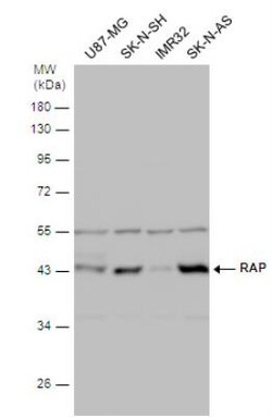 LRPAP Antibody, Novus Biologicals 0.1mL; Unlabeled:Antibodies, Polyclonal