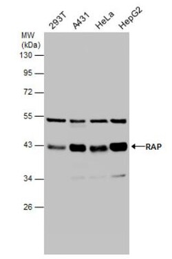 LRPAP Antibody, Novus Biologicals 0.1mL; Unlabeled:Antibodies, Polyclonal