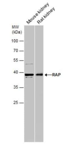 LRPAP Antibody, Novus Biologicals 0.1mL; Unlabeled:Antibodies, Polyclonal