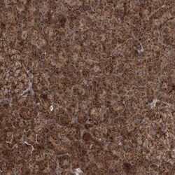 LRPPRC Antibody, Novus Biologicals 25 &mu;L, Unlabeled:Antibodies, Polyclonal