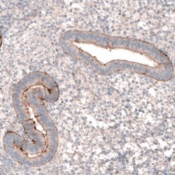 LRRC15 Antibody, Novus Biologicals 0.1mL; Unlabeled:Antibodies, Polyclonal