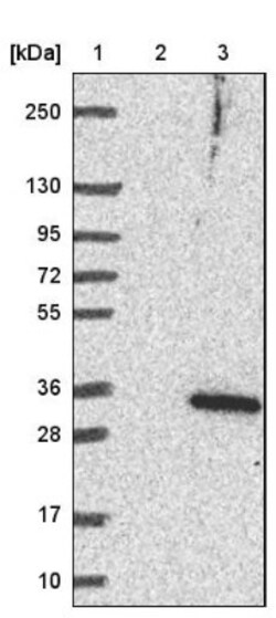 LRRC18 Antibody, Novus Biologicals 25 &mu;L; Unlabeled:Antibodies, Polyclonal
