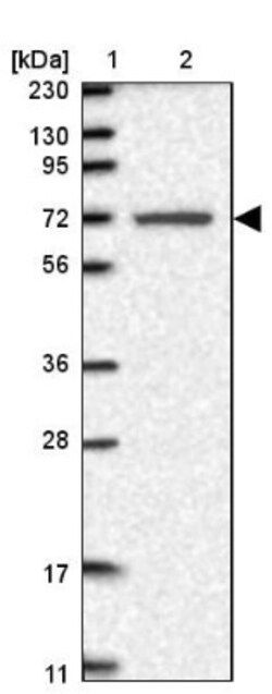 LRRC40 Antibody, Novus Biologicals 25 &mu;L | Buy Online | Novus Biologicals | Fisher Scientific