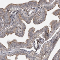 LRRC45 Antibody, Novus Biologicals:Antibodies:Primary Antibodies