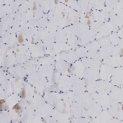LRRC45 Antibody, Novus Biologicals:Antibodies:Primary Antibodies