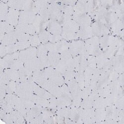 LRRC45 Antibody, Novus Biologicals 25 &mu;L | Buy Online | Novus Biologicals | Fisher Scientific